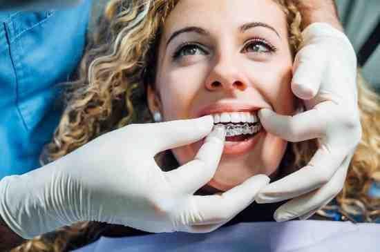 Invisalign Belfast